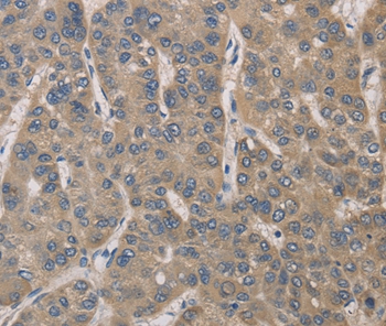 IRAK4 Antibody