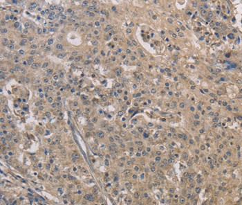 IRAK4 Antibody