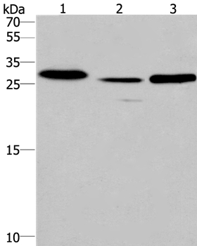 IRAK1BP1 Antibody