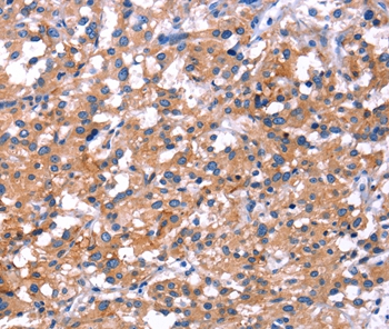 IRS1 Antibody