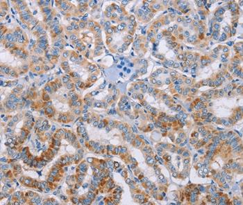 KLK4 Antibody