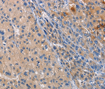 CD207 Antibody