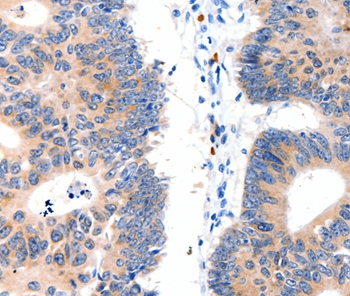 LAT2 Antibody