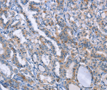 LRRK2 Antibody