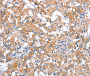 ST14 Antibody