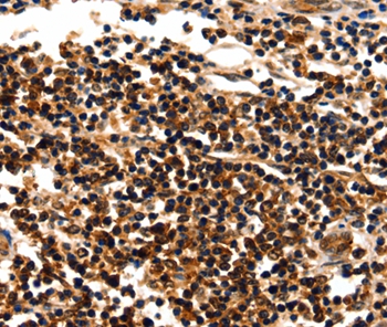 MYOZ1 Antibody