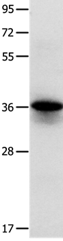 MYOZ1 Antibody