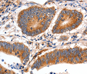 MYH7 Antibody