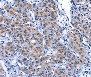 MYH1 Antibody