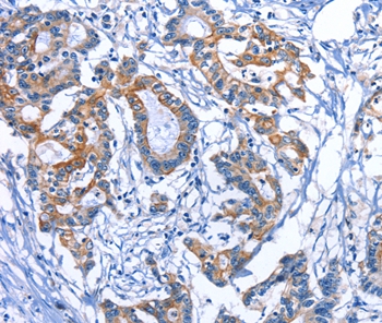 MYH1 Antibody