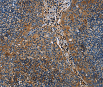 NRN1 Antibody