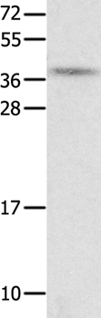 NTS Antibody