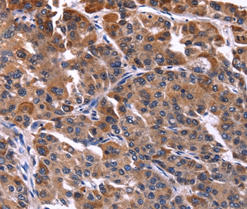 NFATC3 Antibody