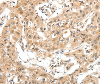 MAP3K14 Antibody