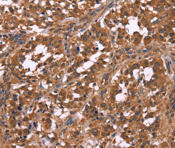 NOS2 Antibody