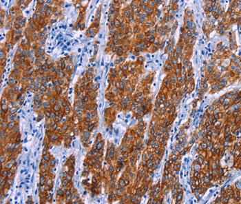 NR4A2 Antibody