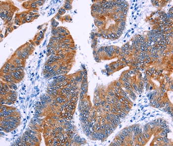 NR4A2 Antibody