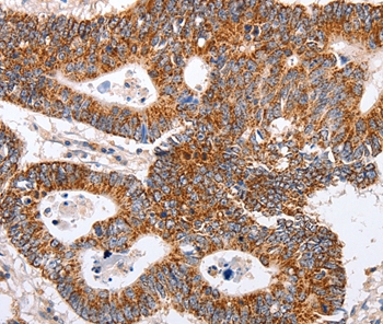 MAP2K5 Antibody