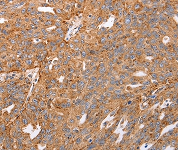 MAP2K5 Antibody