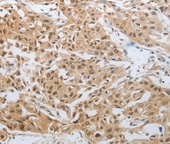 DNAJC7 Antibody
