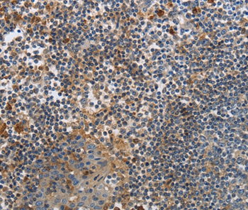 PAK4 Antibody