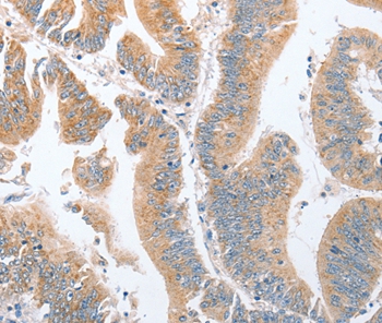 PARD6A Antibody
