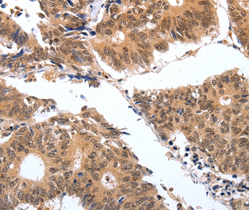 PGC Antibody