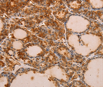 PIK3R1 Antibody