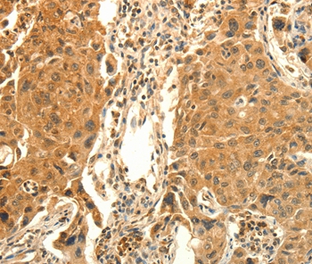 PRKACG Antibody
