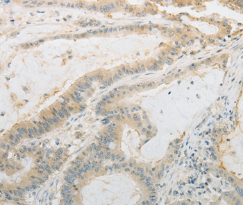 PLAU Antibody