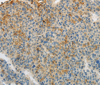 PLAU Antibody