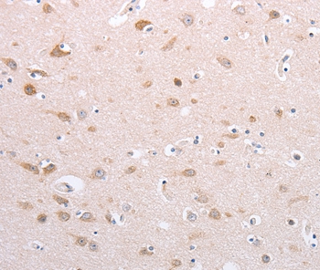 PFN4 Antibody