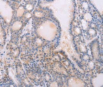 PFN4 Antibody