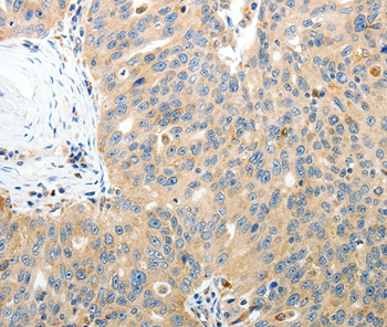 RAMP3 Antibody