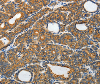 RAMP3 Antibody