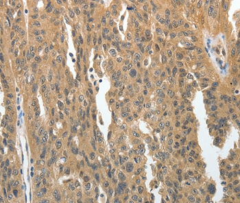 PRMT2 Antibody