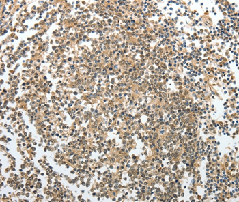PRMT2 Antibody