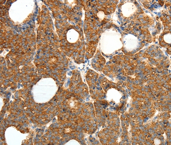 PRDX3 Antibody