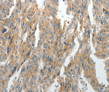 PRDX5 Antibody