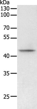 PHF6 Antibody
