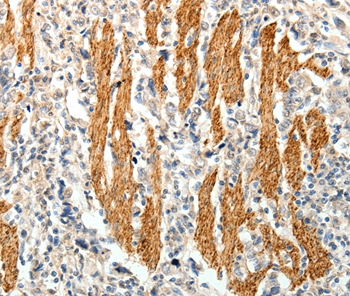 PTHLH Antibody