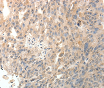 PTHLH Antibody
