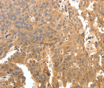 PTPRE Antibody