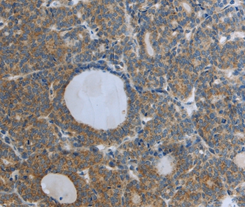RETN Antibody