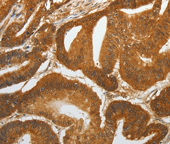 RETNLB Antibody