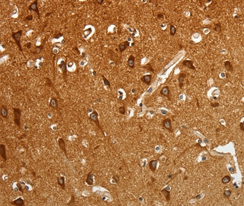 RGS2 Antibody