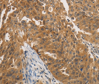 PTPN11 Antibody