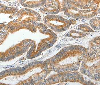 SLC12A4 Antibody