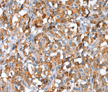SNAI1 Antibody