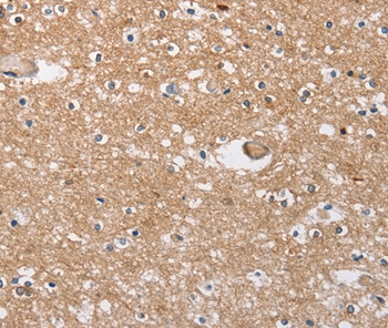 SOCS2 Antibody